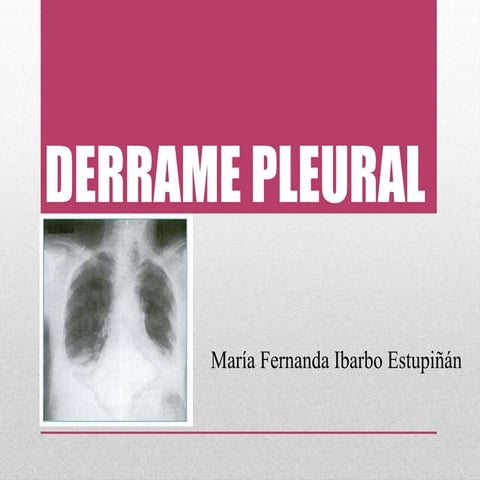 DERRAME PLEURAL