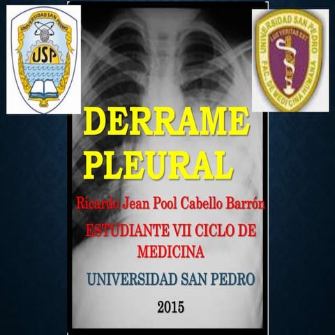 Derrame Pleural - Harrison 18 edicion 2015