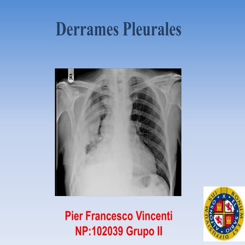 Derrames pleurales