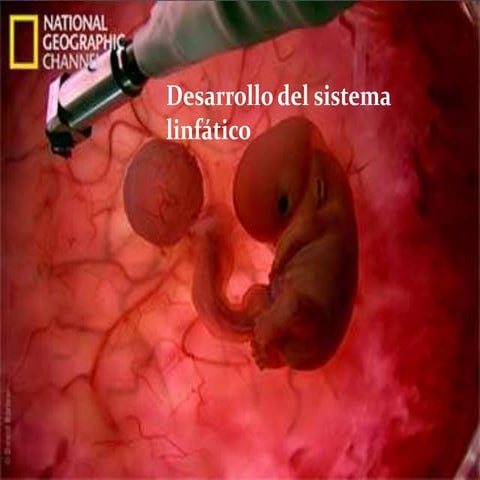 Desarrollo de sitema linfatico