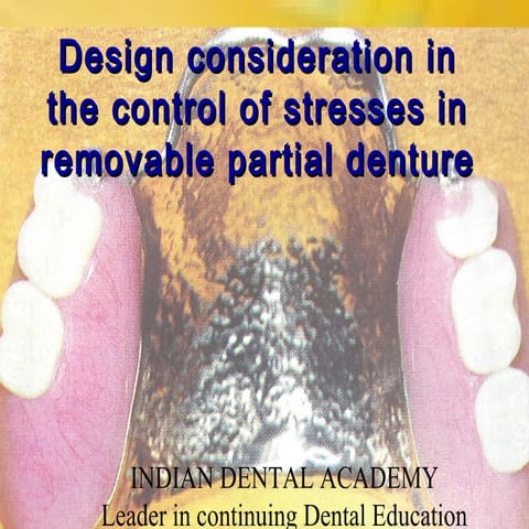 Design consideration in reducing stress in rpd/ oral surgery courses  