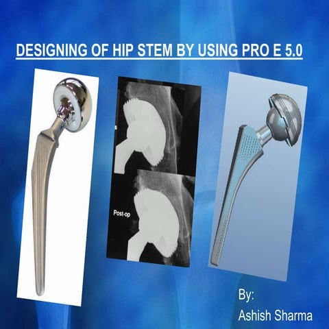 HIPS STEM DESIGN-- Ashish Sharma