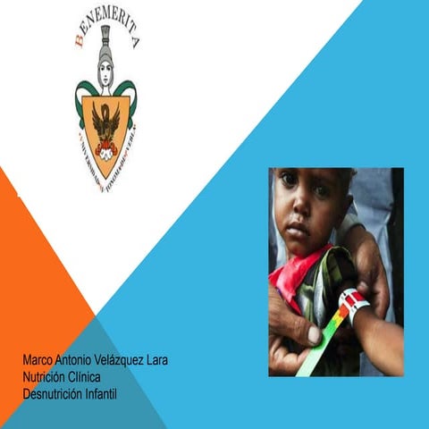 Desnutrición infantil