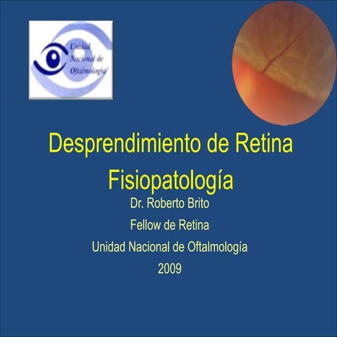 Desprendimiento de retina