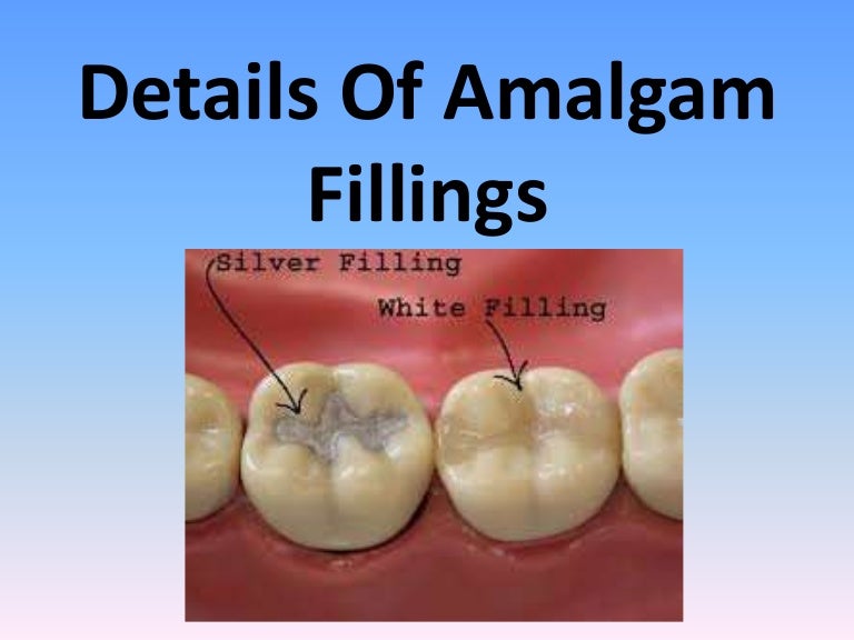 Details Of Amalgam Fillings