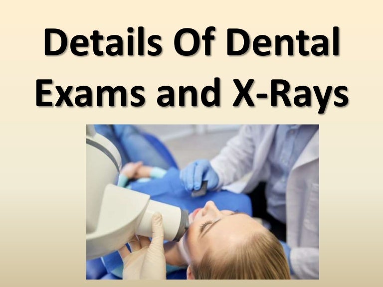 Details Of Dental Exams and XRays