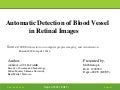 Undergraduate student thesis exudate detection retinal images 08 image