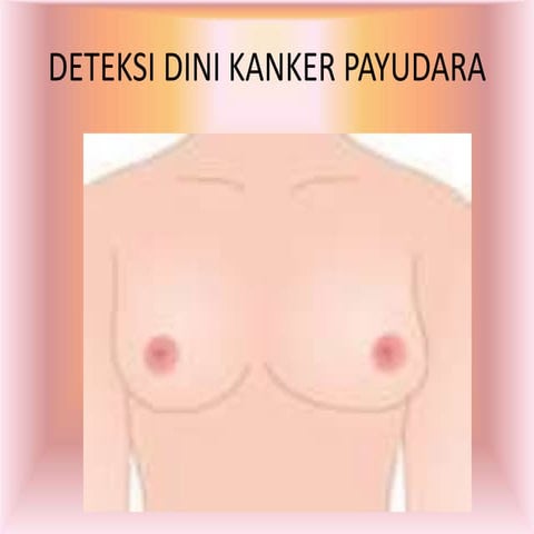 deteksi-kanker-payudara-3.ppt