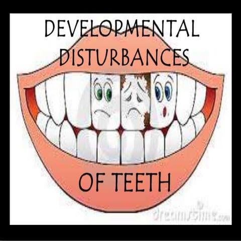 Developmental anomalies of teeth - by  variyta