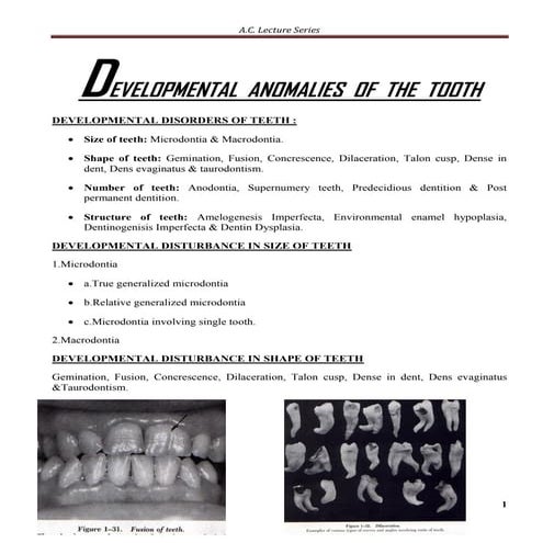 Developmental anomalies of the tooth