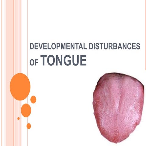 Developmental disturbances of tongue