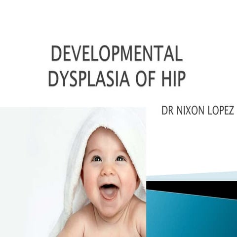 DEVELOPMENTAL DYSPLASIA OF HIP.pptx