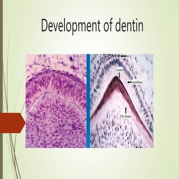 Development of dentin