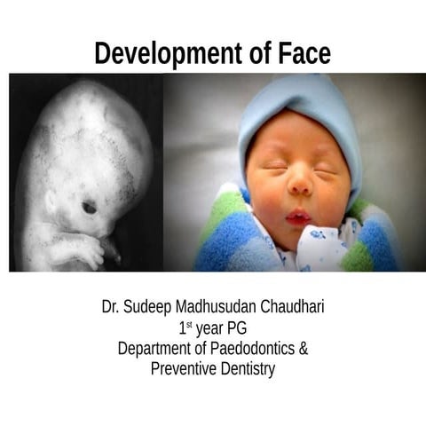 DEVELOPMENT OF THE FACE (EMBRYOLOGY) Time Period 4th to 8th week of ...
