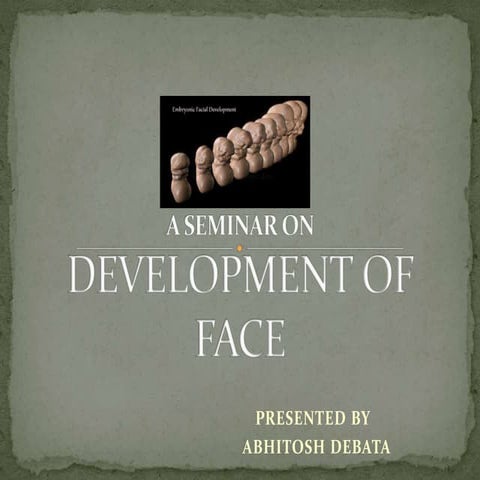 Development of face & Developmental anomalies