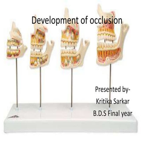 Development of occlusion_kritika