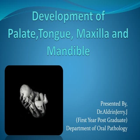 Development of palate, tongue, maxilla and mandible