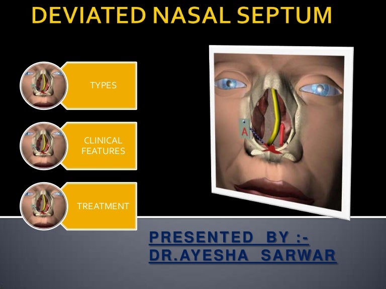 Deviated Septum X Ray