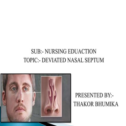 DEVIATED NASAL SEPTUM AND ITS MANAGEMENT.pdf