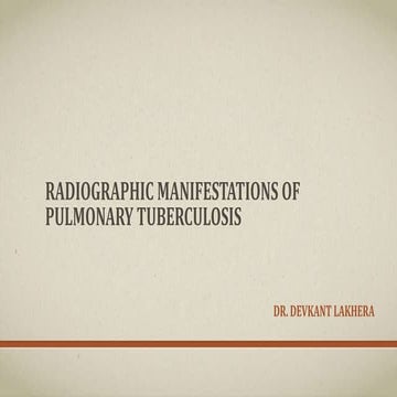 Radiographic manifestations of pulmonary tuberculosis