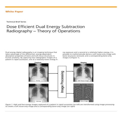 Dose Efficient Dual Energy Subtraction Radiography - Theory of Operations