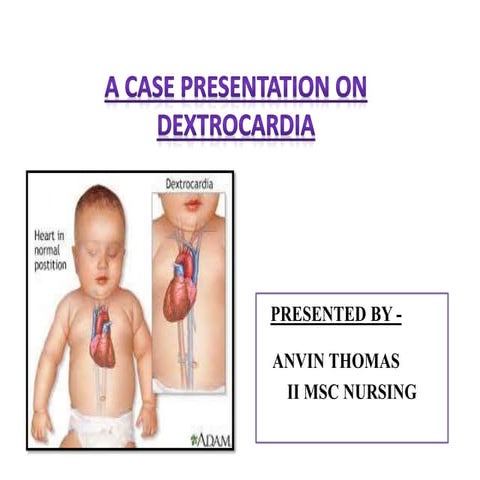 Dextro cardia a rare case