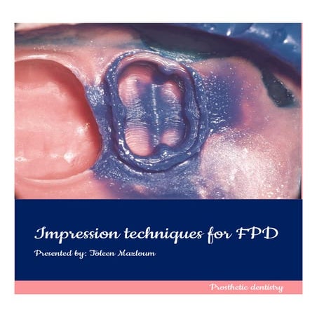impression techniques for FPD 