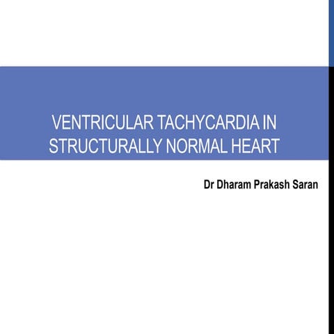 ventricular tachycardia (VT) Localisation | PPT