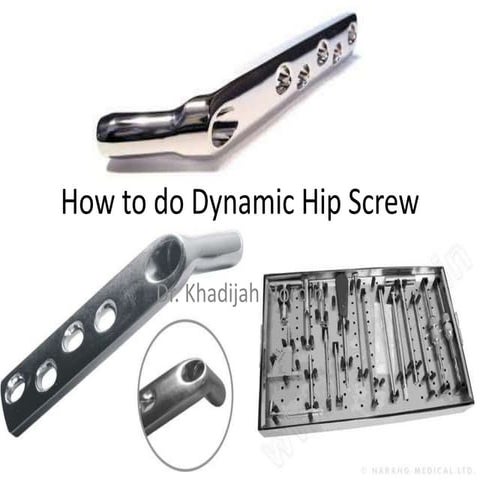 dynamic hip screw