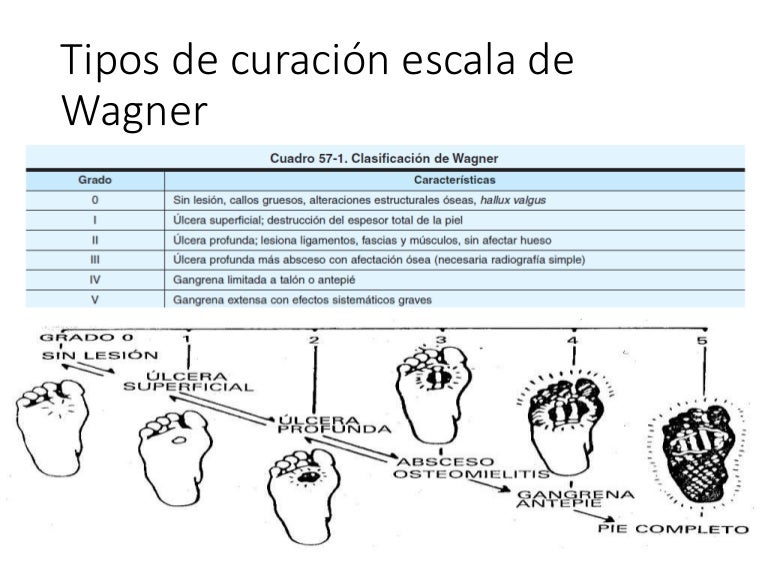 pie diabetico (wagner)