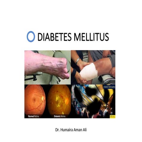 Diabetes Milliteus (type1 and type 2) and diorders
