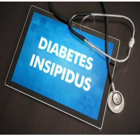 diabetesinsipidus.pptx in childhood endocrinology