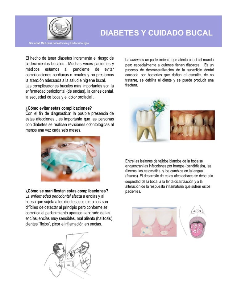 gusto en la boca diabetes