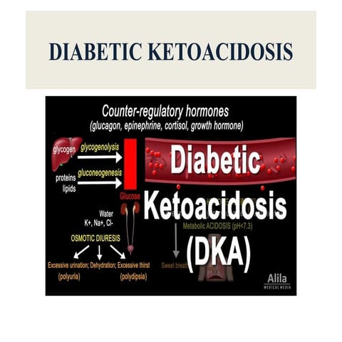 DIABETIC KETOACIDOSIS - A major issue pptx
