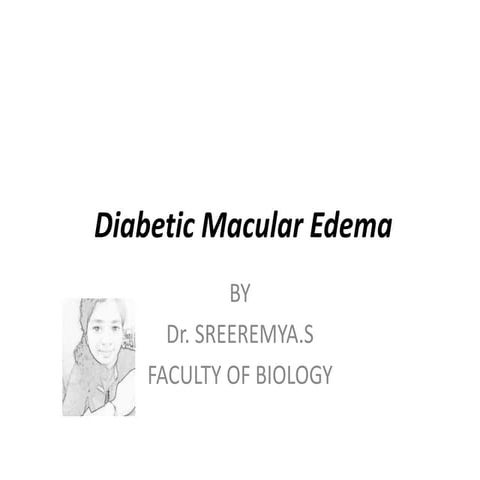 Diabetic macular edema