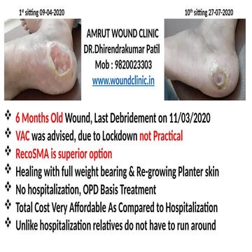 Diabetic Wound care advances and management | PPTX