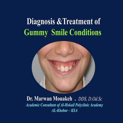 Diagnosis and treatment of gummy smile