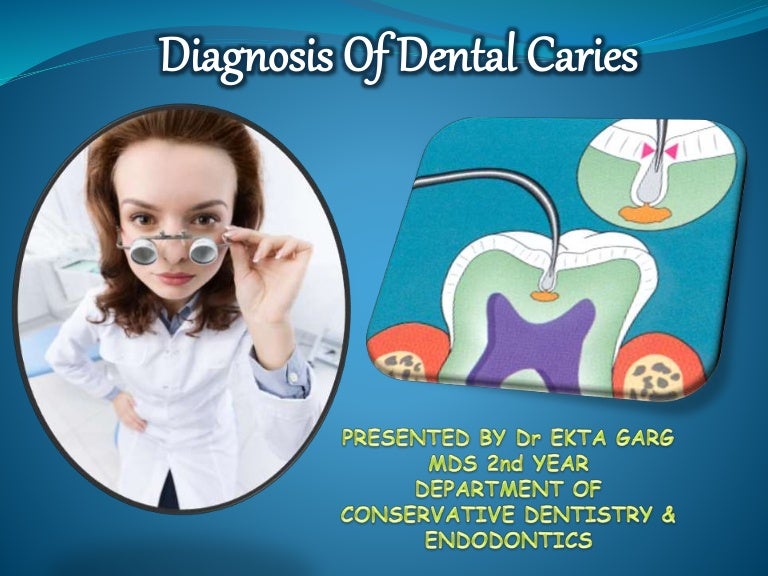 Dental Caries Diagnosis