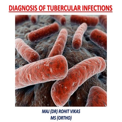 Diagnosis of Tuberculosis