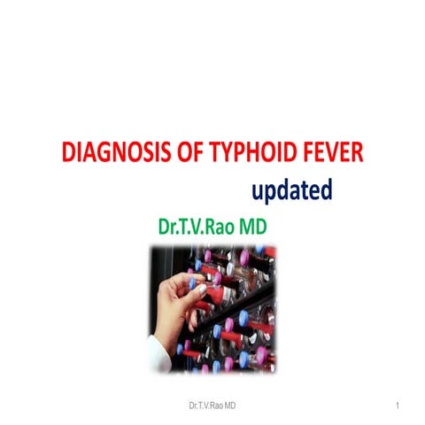 DIAGNOSIS OF TYPHOID FEVER | PPTX