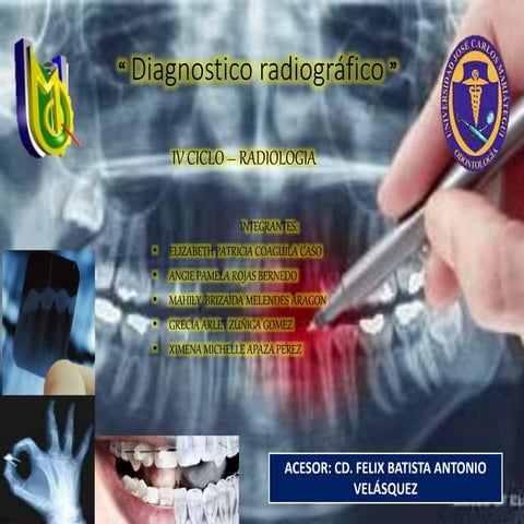 Rx de mandibula | PPTX