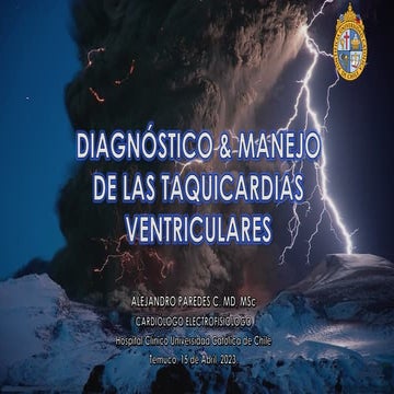 Diagnóstico y manejo de las taquicardias ventriculares (TV)