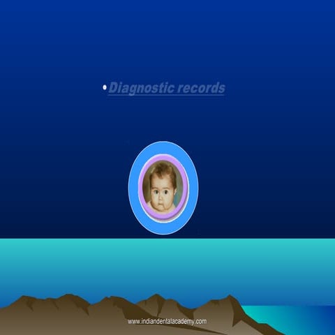 Diagnostic records /certified fixed orthodontic courses by Indian dental acad...