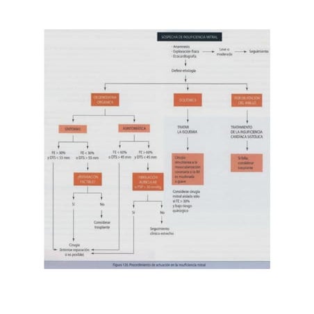Algoritmos de Insuficiencia Mitral