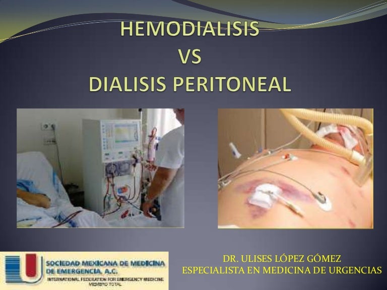 Dialisis Peritoneal vs Hemodialisis