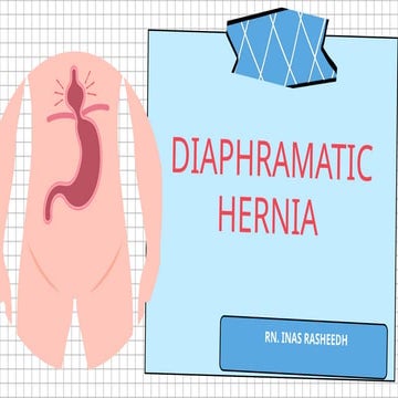Diaphragmatic Hernia: Understanding the Anatomy, Diagnosis, and Management