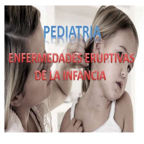 Enfermedades eruptivas    de la infancia
