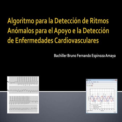 Proyecto de Tesis Pregrado - Algoritmo detector de Arritmias Simples