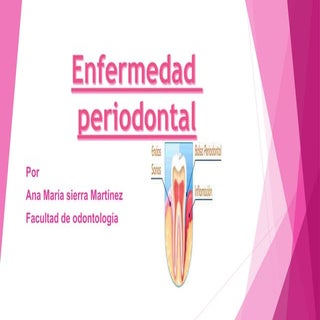 Diapositivas enfermedad periodontal