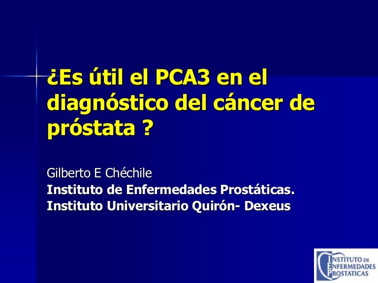 costo de examen de próstata pca3 en